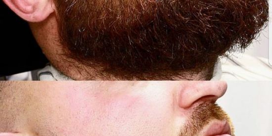 Imagem do grupo de WhatsApp Curso de barbeiro!✂️🪒💈