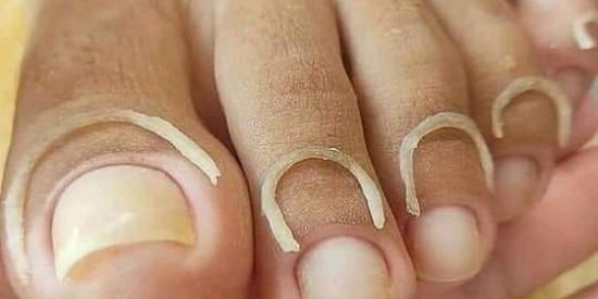 Imagem do grupo de WhatsApp Curso de cutilagem por R$19,90