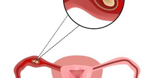 Imagem do grupo de WhatsApp Gestação Ectópica