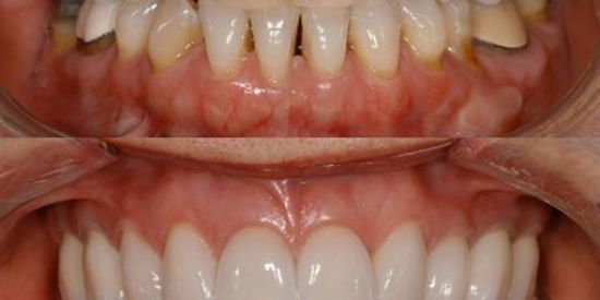 Imagem do grupo de WhatsApp Jovens e coroas 👩🏼‍🦰🧑🏼‍🦳👨🏼‍🦰👨🏼‍🦳