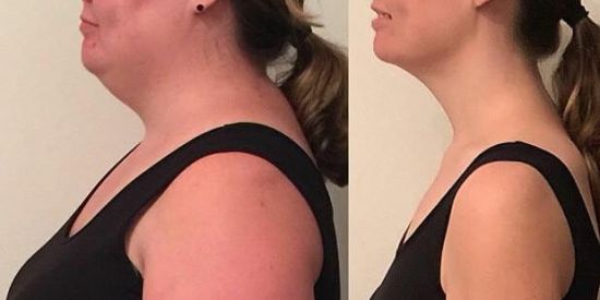 Imagem do grupo de WhatsApp Emagreça com saúde