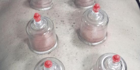 Imagem do grupo de WhatsApp Ventosaterapia