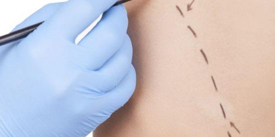 Imagem do grupo de WhatsApp Cirugia plástica