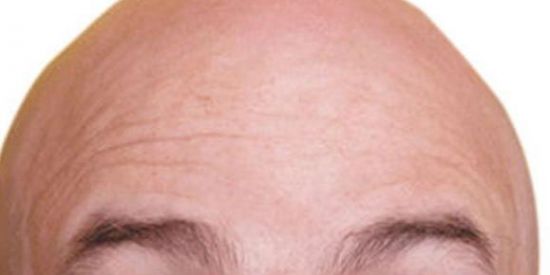 Imagem do grupo de WhatsApp Grupo dos "careca"👨‍🦲🦲