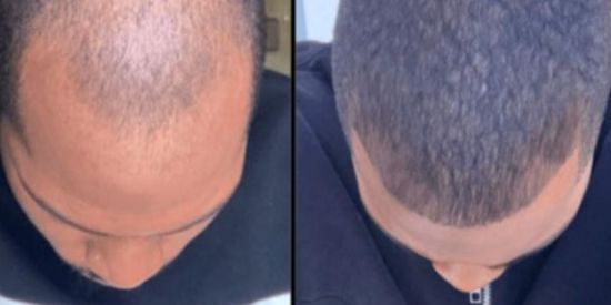 Imagem do grupo de WhatsApp 100 QUEDAS💇🏻‍♂️💈