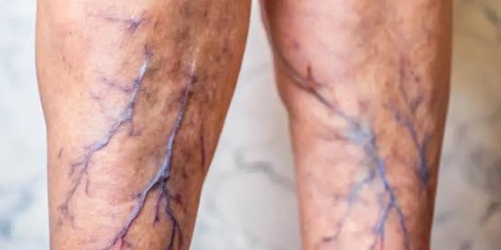 Imagem do grupo de WhatsApp #3 ADEUS VARIZES 💚💉