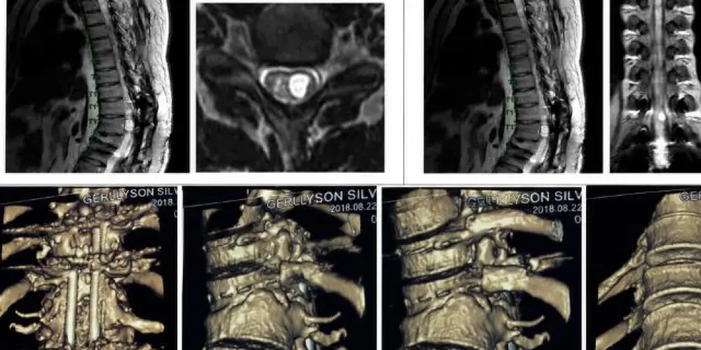 Imagem do grupo de WhatsApp Ajuda Cirurgia na Coluna