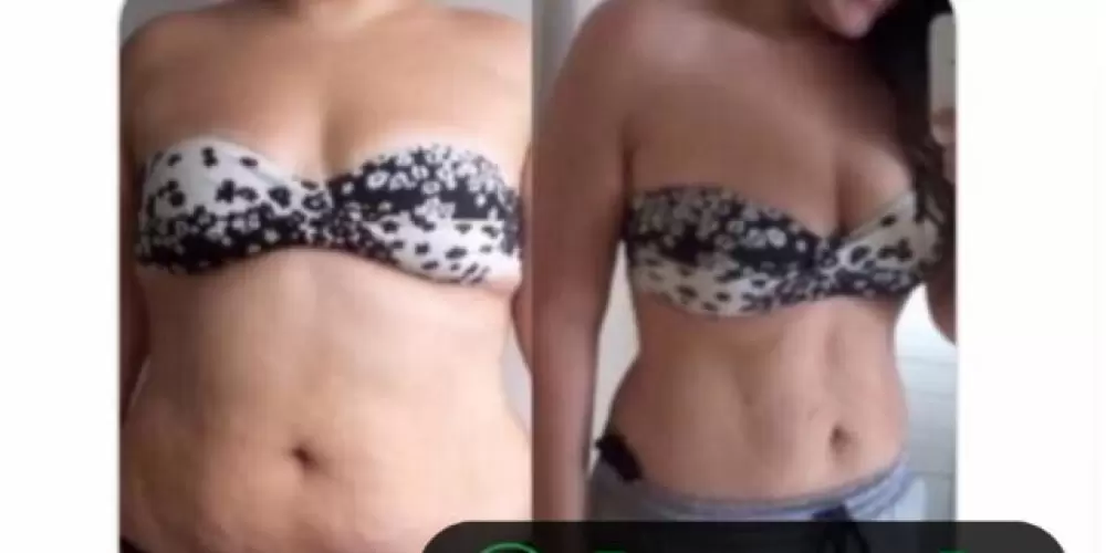 Imagem do grupo de WhatsApp Emagrecimento_Pro