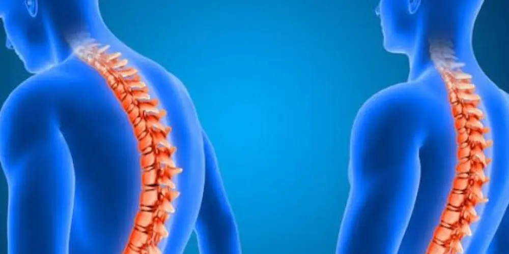 Imagem do grupo de WhatsApp Escoliose na coluna