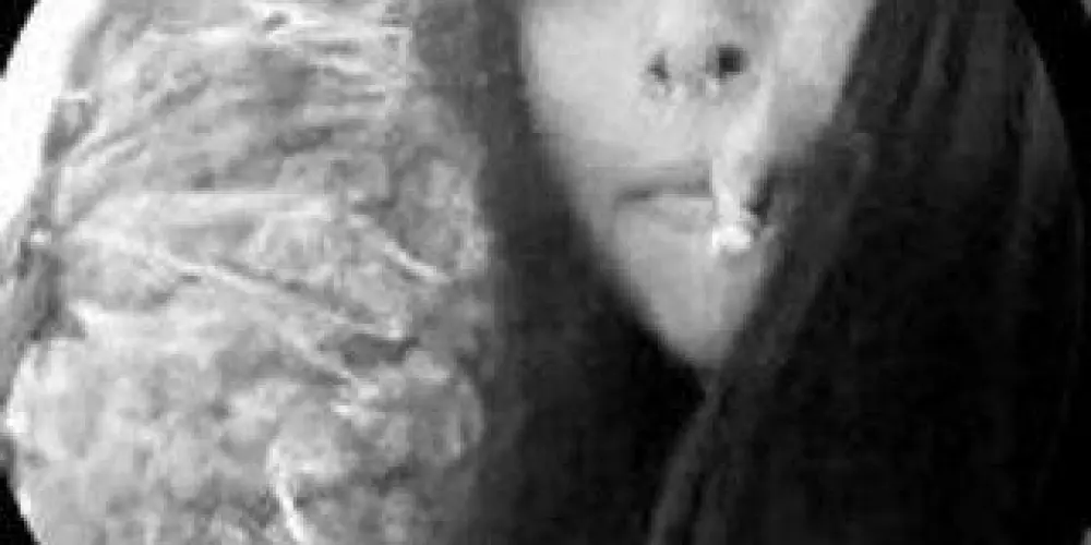 Imagem do grupo de WhatsApp Turma do chaves pelado