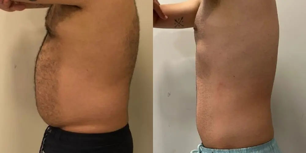 Imagem do grupo de WhatsApp Vitallys Emagrecimento Rápido (2)